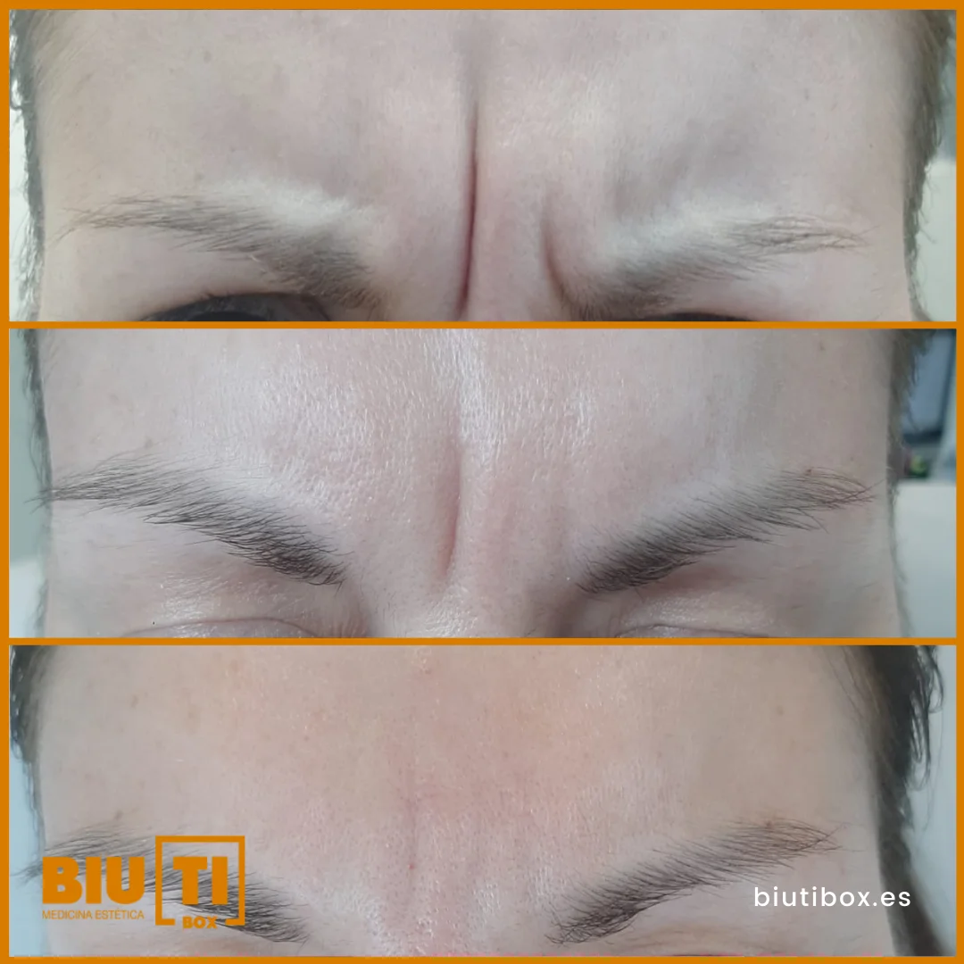 Clínica de Medicina Estética BiutiBox - Bild 3
