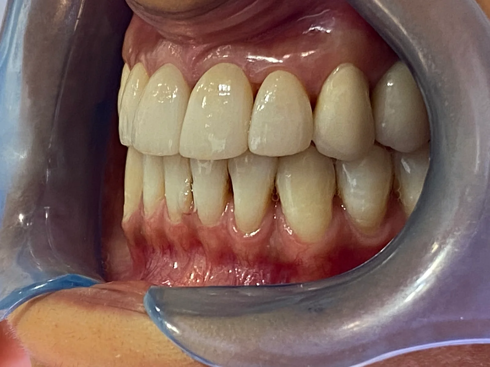 Clínica Dental Llibertat - Bild 6