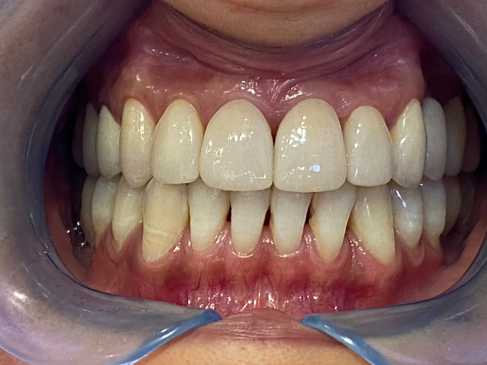 Clínica Dental Llibertat - Bild 7