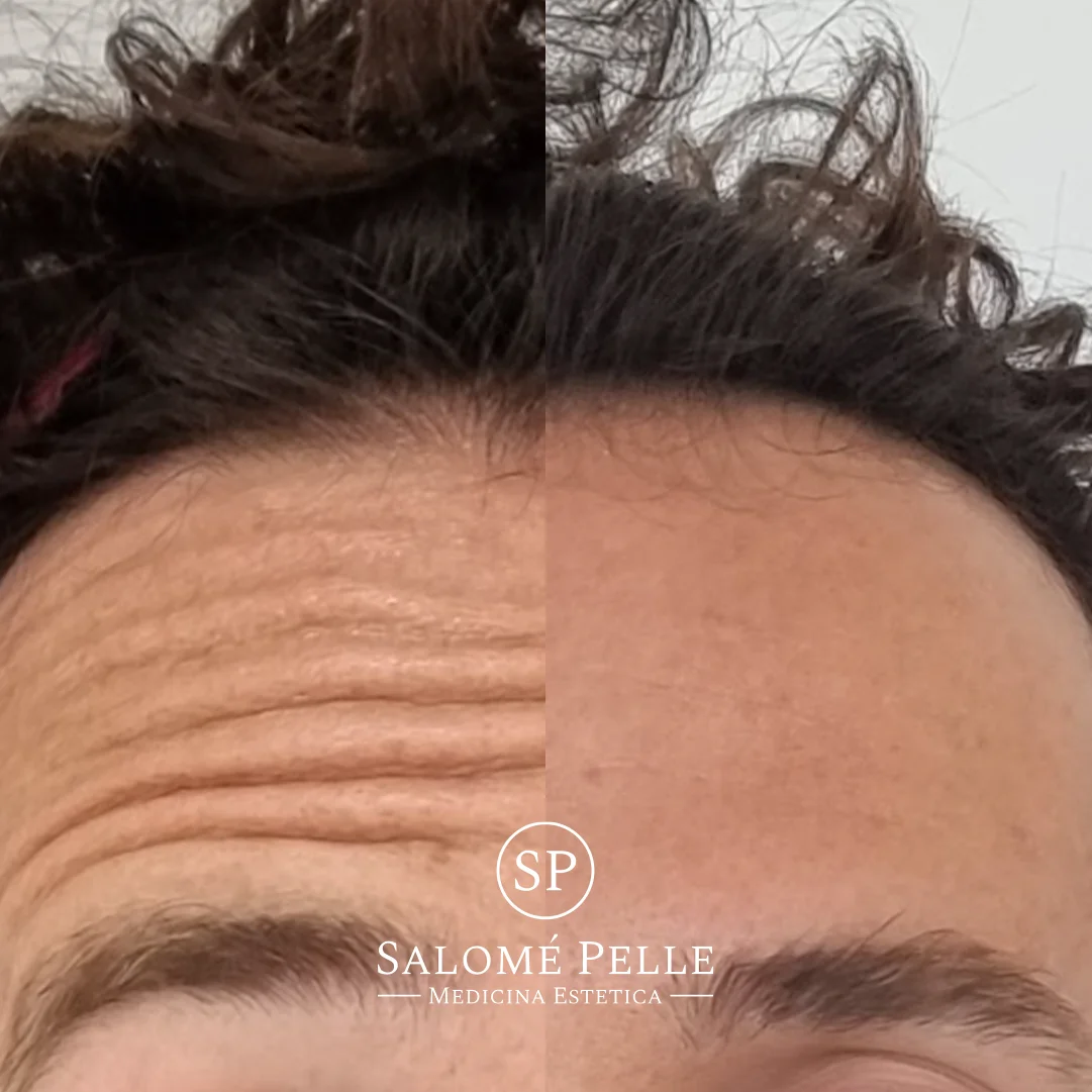 Dra. Salomé Pelle Clínica Estética y Medicina Estética - Bild 10