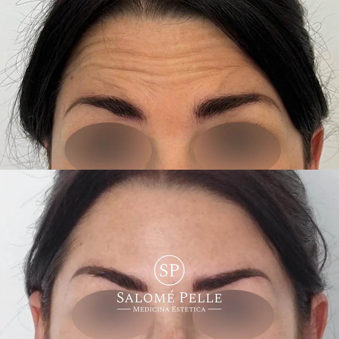 Dra. Salomé Pelle Clínica Estética y Medicina Estética - Bild 9