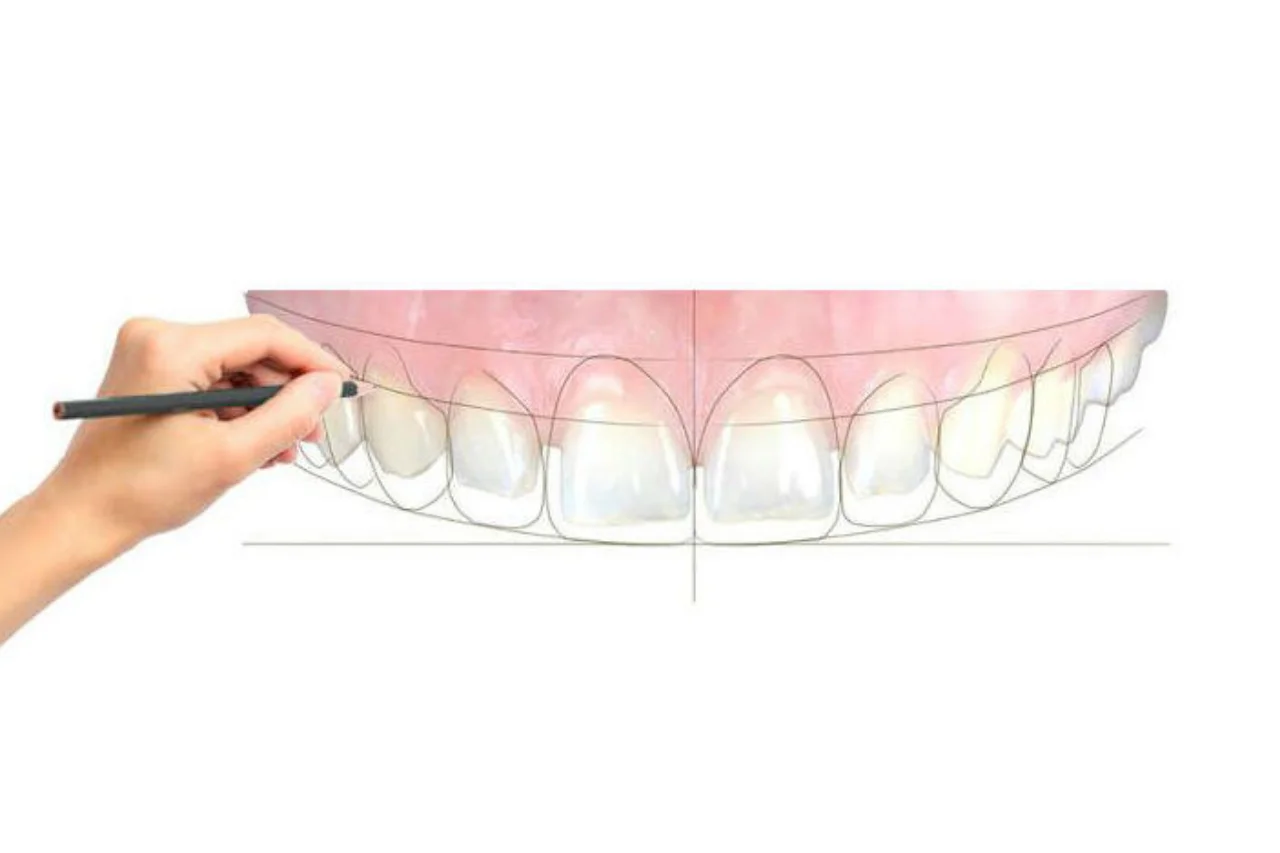 Clínica Dental Castañer - Bild 4