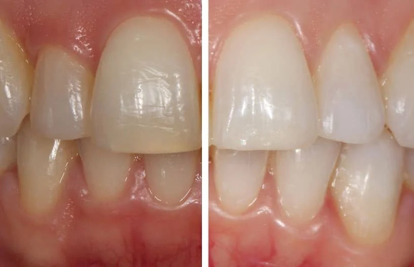 Clínica Dental Delgado - Bild 9