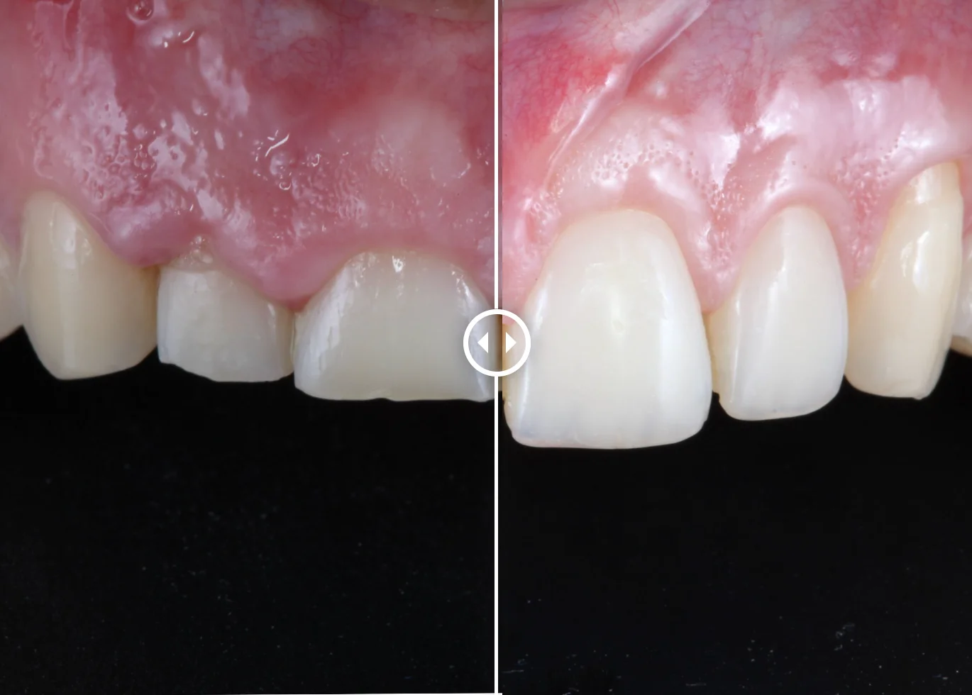 Clínica Dental Franch-Adriaens Odontología Avanzada - Bild 7