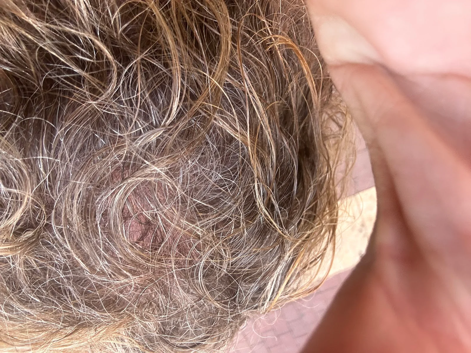 Mara Aesthetics S.L., Cirugía Plástica y Estética Mallorca - Bild 4