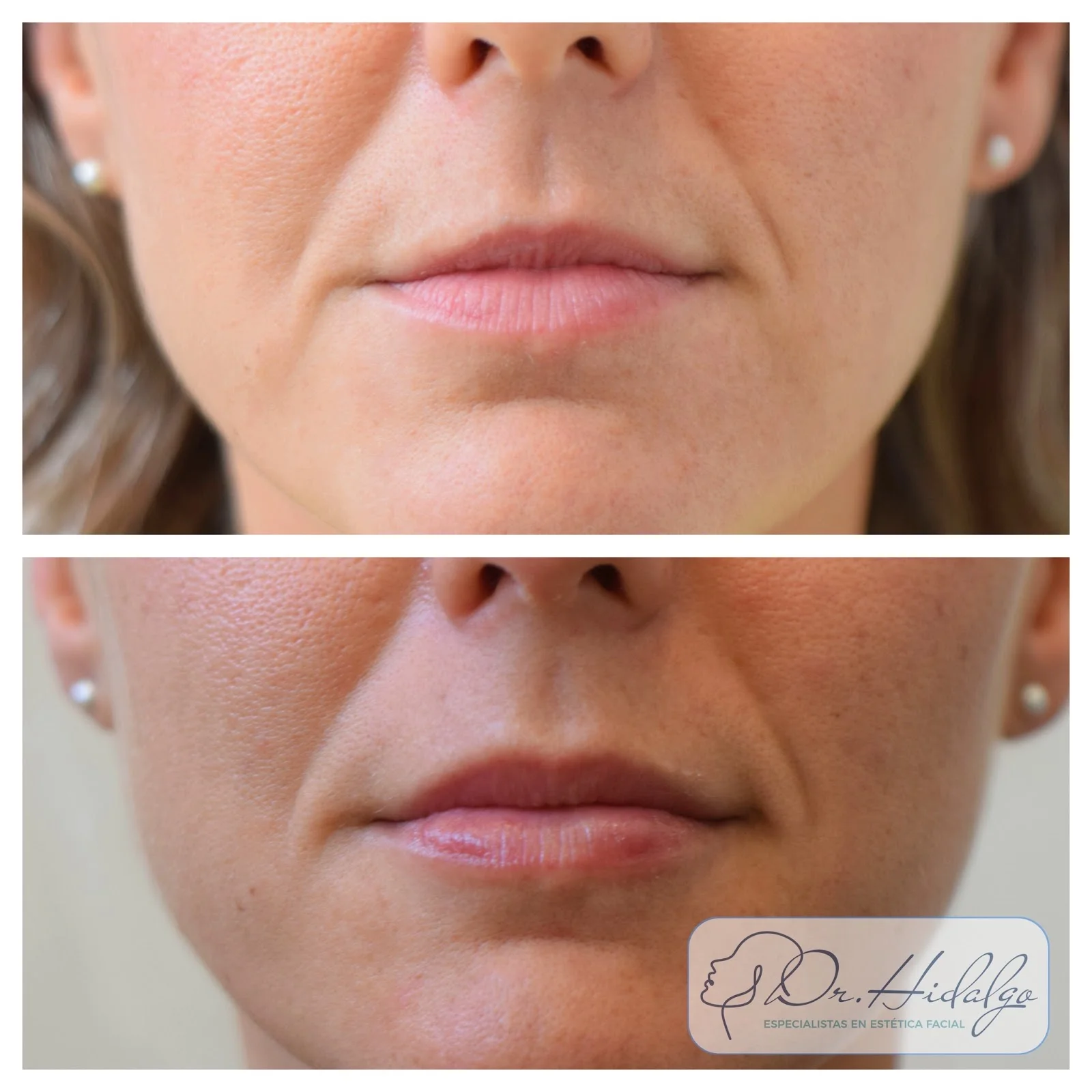 Clínica One Face - Bild 8