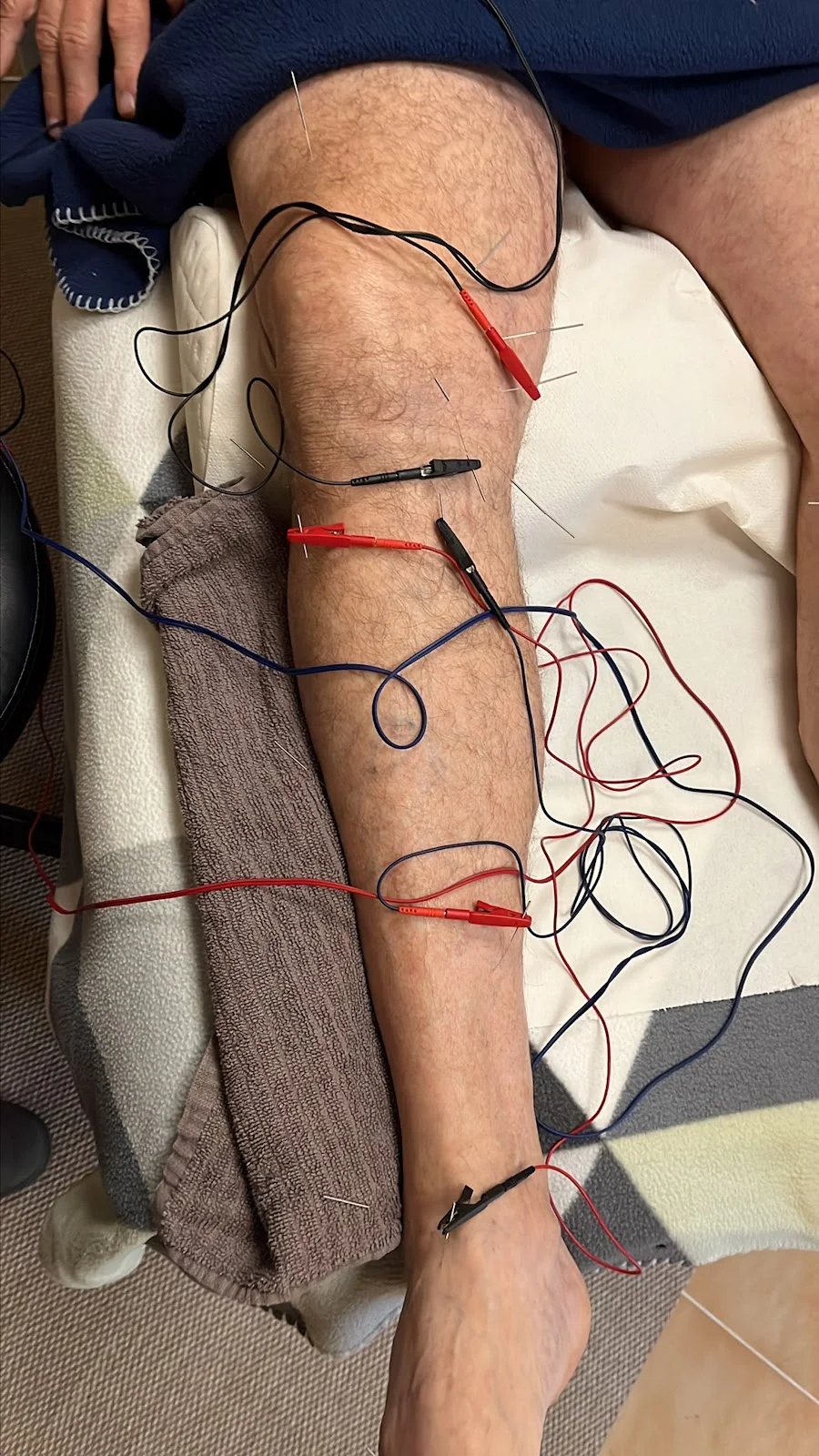 Centro Raul Martinez Osteopatía & Acupuntura - Bild 4