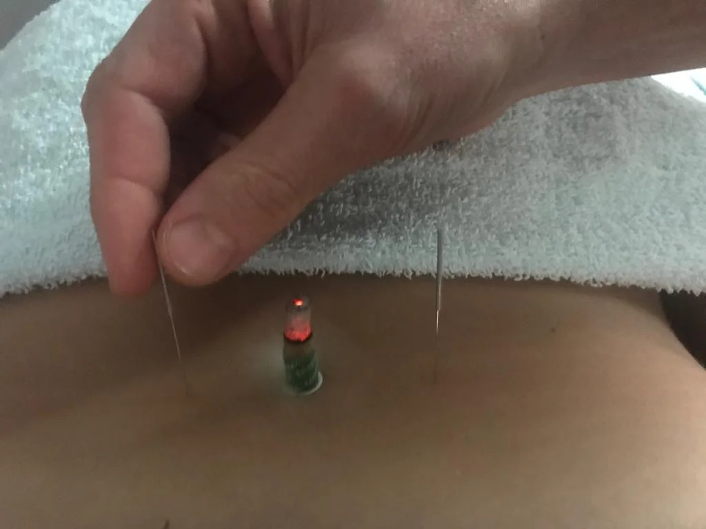 Centro Raul Martinez Osteopatía & Acupuntura - Bild 5