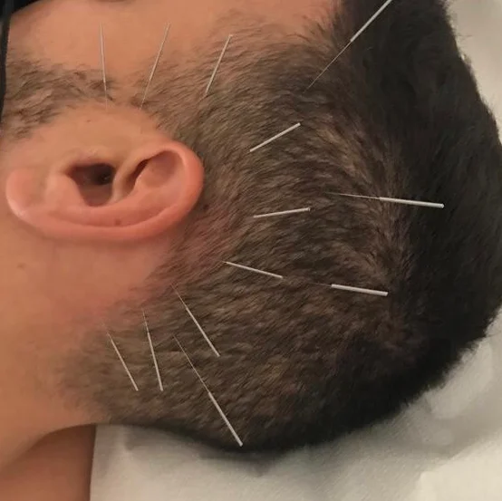 Centro Raul Martinez Osteopatía & Acupuntura - Bild 10